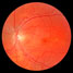 Retina