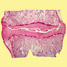 intervertebral disc