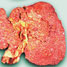 Liver