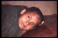 Ethiopian child with malaria