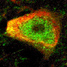 nanoparticle