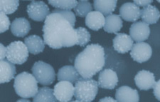 Nanoparticles
