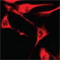 Stained cell culture