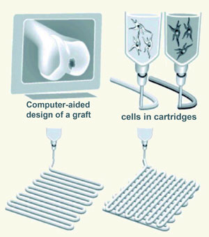 Printing organs with hydrogels
