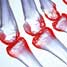 Inflamed joints