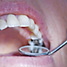 dental work