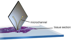 Diamond-shaped probe used to analyse tissue samples  