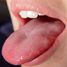 tongue
