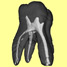 Density scan of a tooth