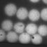 Vesicles