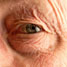 Wrinkles