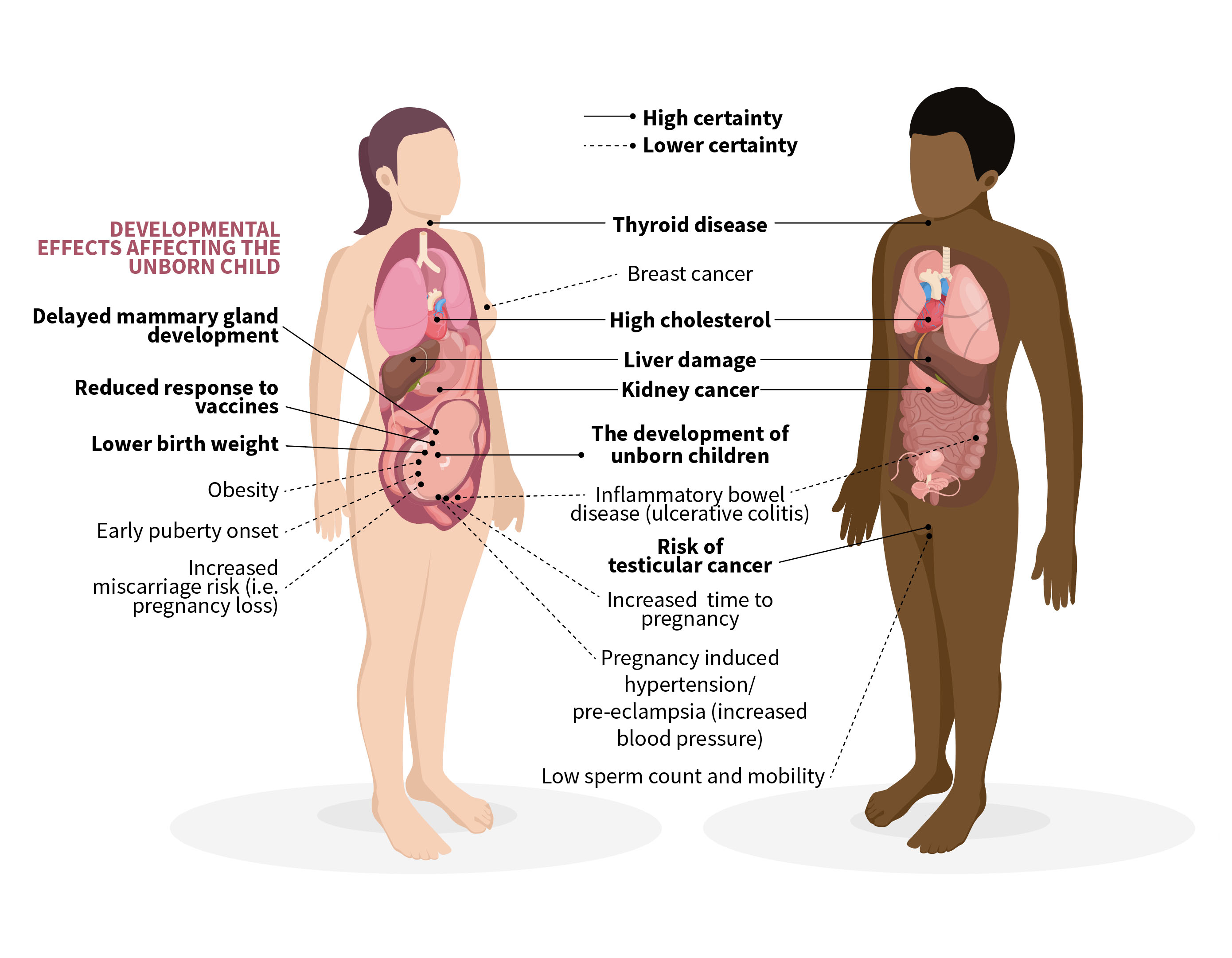 The diagram shows a biopsied white woman and a black man with lines coming off their torsos linking to labels that detail the various health hazards associated with prolonged exposure to elevated levels of PFAS. The ailments affecting women with a high degree of certainty are thyroid disease, high cholesterol, liver damage and kidney cancer; the conditions affecting women with lower certainty are inflammatory bowel disease, increased time to pregnancy and pregnancy-induced hypertension/pre-eclampsia. The female body also has lines coming off that relate to a range of impact on the development of unborn children (namely, delayed mammary gland development, reduced response to vaccines, and lower birth weight, which are all considered high certainty; and obesity, early puberty onset and increased miscarriage risk, which are all consider lower certainty). The conditions coming off the male are also split into high and lower certainty risk categories. High-certainty ailments affecting men are thyroid disease, high cholesterol, liver damage, kidney cancer, and an elevated risk of testicular cancer; lower-certainty issues are inflammatory bowel disease and low sperm count and mobility. The diagram shows a biopsied white woman and a black man with lines coming off their torsos linking to labels that detail the various health hazards associated with prolonged exposure to elevated levels of PFAS. The ailments affecting women with a high degree of certainty are thyroid disease, high cholesterol, liver damage and kidney cancer; the conditions affecting women with lower certainty are inflammatory bowel disease, increased time to pregnancy and pregnancy-induced hypertension/pre-eclampsia. The female body also has lines coming off that relate to a range of impact on the development of unborn children (namely, delayed mammary gland development, reduced response to vaccines, and lower birth weight, which are all considered high certainty; and obesity, early puberty onset and increased miscarriage risk, which are all consider lower certainty). The conditions coming off the male are also split into high and lower certainty risk categories. High-certainty ailments affecting men are thyroid disease, high cholesterol, liver damage, kidney cancer, and an elevated risk of testicular cancer; lower-certainty issues are inflammatory bowel disease and low sperm count and mobility.